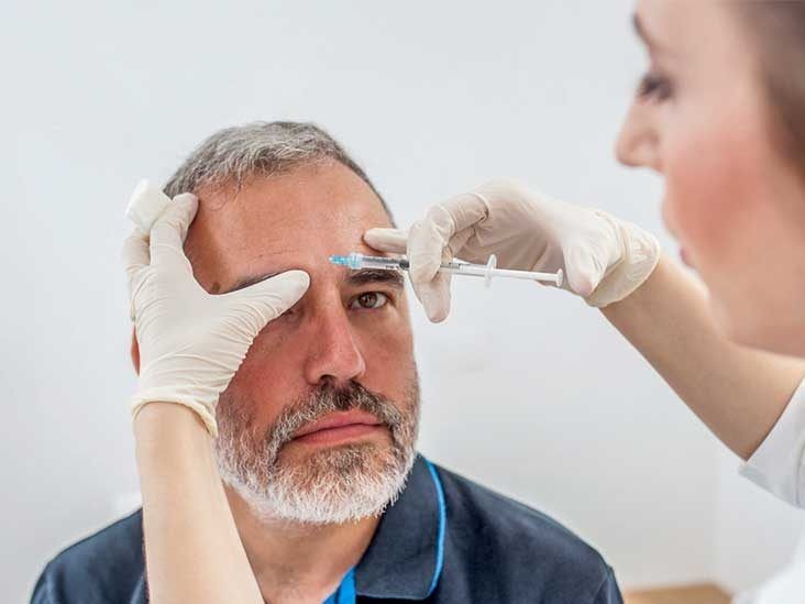 Botox and Migraine Triggers: Can It Really Break the Cycle?